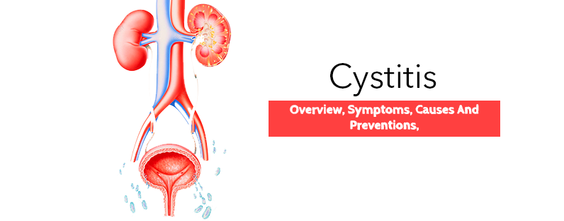 Cystitis- Overview, Symptoms, Causes And Preventions,