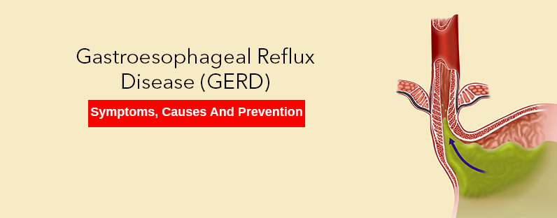 Gastroesophageal Reflux Disease (GERD) – Symptoms, Causes And Prevention