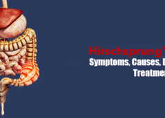 Hirschsprung’s Disease- Symptoms, Causes, Diagnosis And Treatment