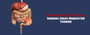 Hirschsprung's Disease- Symptoms, Causes, Diagnosis And Treatment