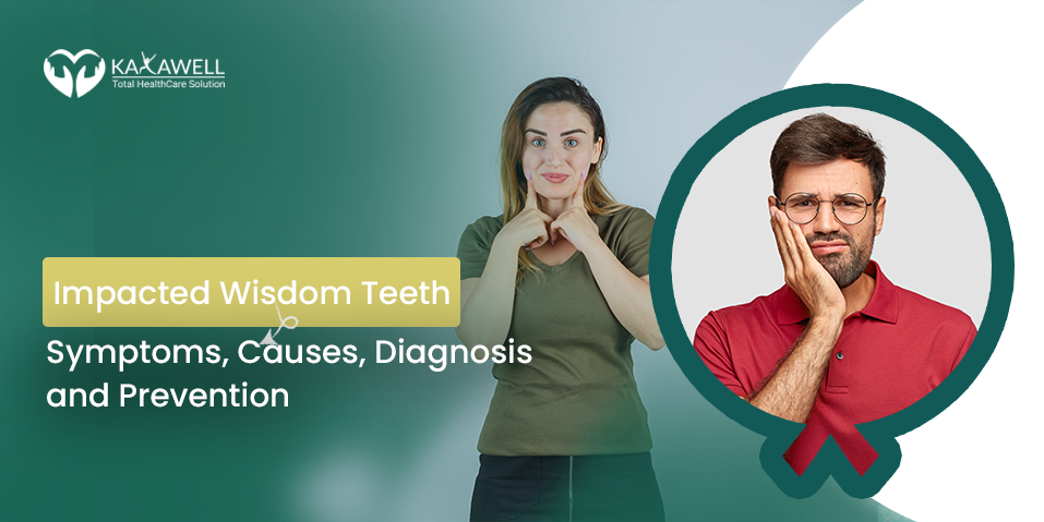 Impacted Wisdom Teeth- Symptoms, Causes, Diagnosis and Prevention