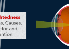Nearsightedness- Symptoms, Causes, Risk Factor and Prevention-1