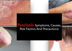 Psoriasis- Symptoms, Causes, Risk Factors and Precautions