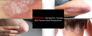 Psoriasis- Symptoms, Causes, Risk Factors And Precautions