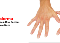 Scleroderma- Symptoms, Causes, Risk Factors and Precautions