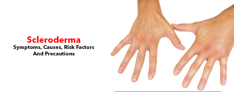 Scleroderma- Symptoms, Causes, Risk Factors And Precautions