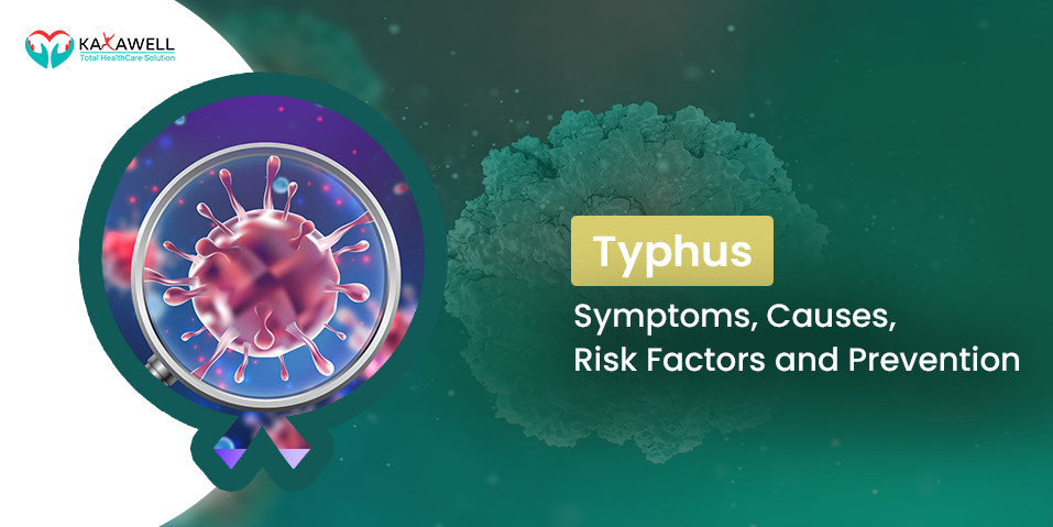 Typhus