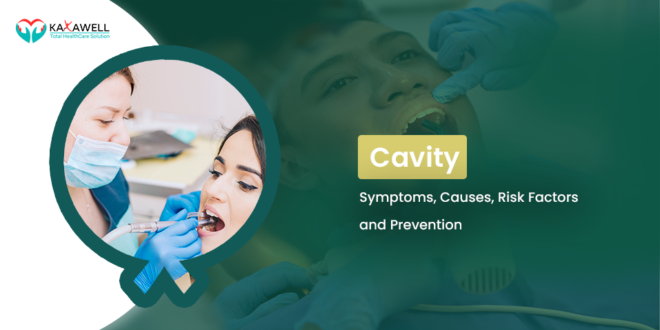 Cavity- Symptoms, Causes, Risk Factors and Prevention
