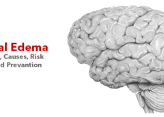 Cerebral Edema- Symptoms, Causes, Risk Factors and Prevantion