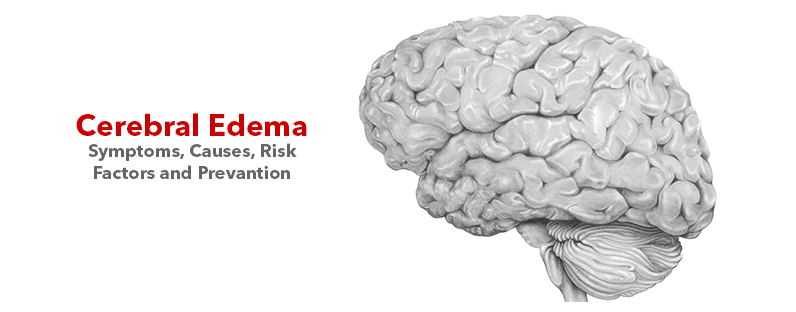 Cerebral Edema- Symptoms, Causes, Risk Factors and Prevantion