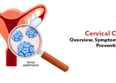 Cervical Cancer- Overview, Symptoms, Causes and Prevention