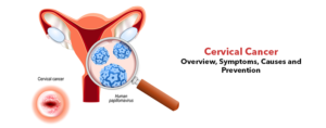 Cervical Cancer- Overview, Symptoms, Causes and Prevention