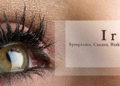 Iritis-Symptoms, Causes, Risk Factors and Home Remedies