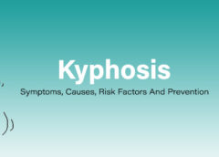 Kyphosis- Symptoms, Causes, Risk Factors and Prevention