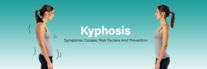 Kyphosis--Symptoms,-Causes,-Risk-Factors-And-Prevention
