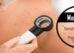 Melanoma-Symptoms, Causes and Prevention Tips