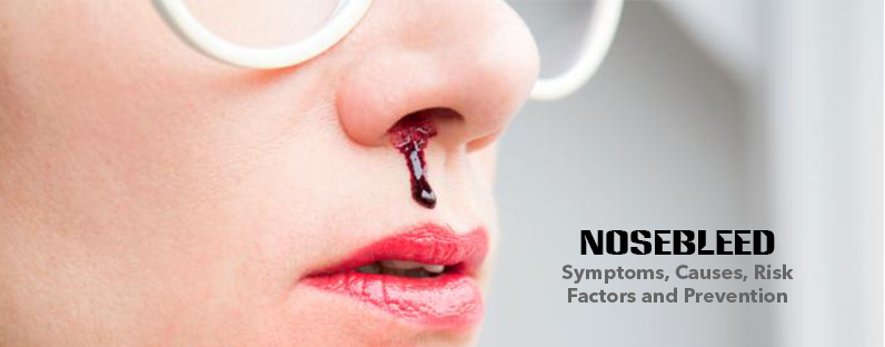 Nosebleed- Symptoms, Causes, Risk Factors and Prevention