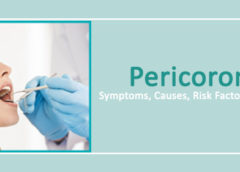 Pericoronitis