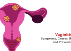 Vaginitis- Symptoms, Causes, Risk Factors and Prevention