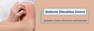 Bedsores-(Decubitus-Ulcers)-–-Symptoms,-Causes,-Risk-Factors-And-Prevention