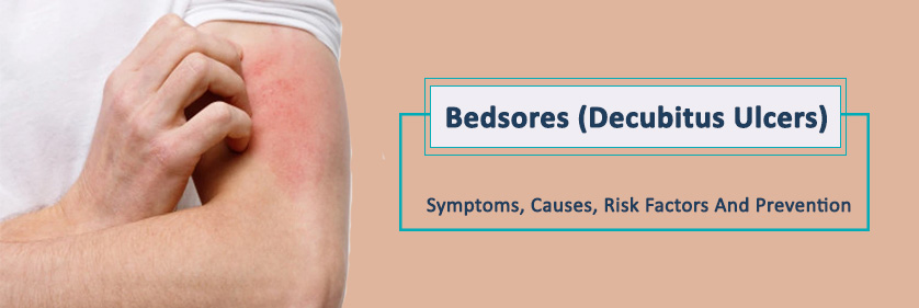 Bedsores-(Decubitus-Ulcers)-–-Symptoms,-Causes,-Risk-Factors-And-Prevention