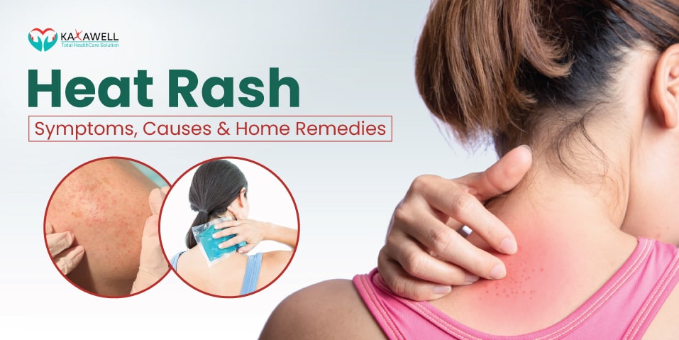 Person scratching a heat rash on the neck, with close-up images of heat rash and a cold compress treatment.