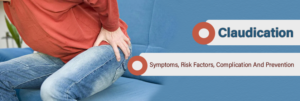 Claudication- Symptoms, Risk Factors, Complication And Prevention