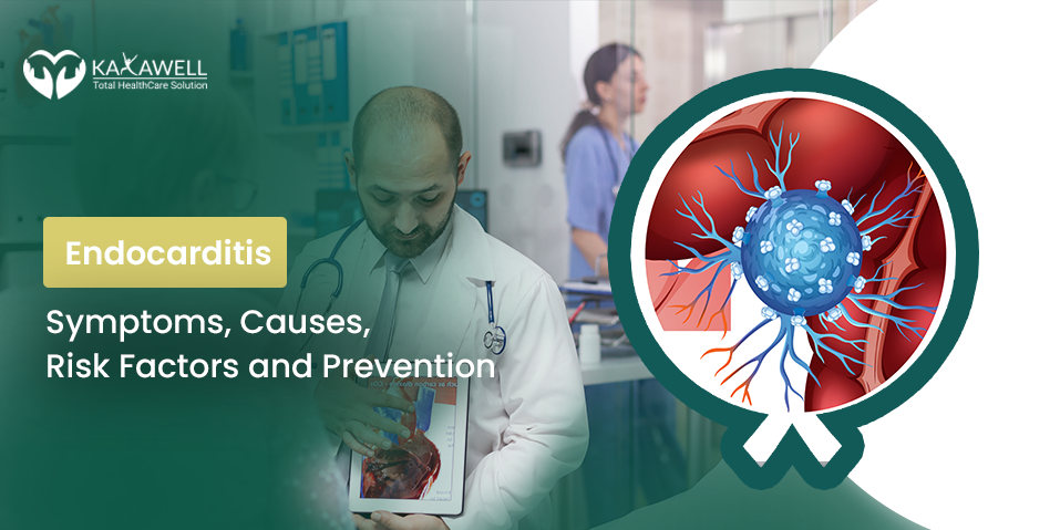 Endocarditis- Symptoms, Causes, Risk Factors and Prevention