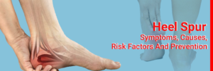 Heel-Spur--Symptoms,-Causes,-Risk-Factors-And-Prevention