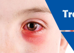 Trachoma- Symptoms, Causes, Risk Factors and Prevention
