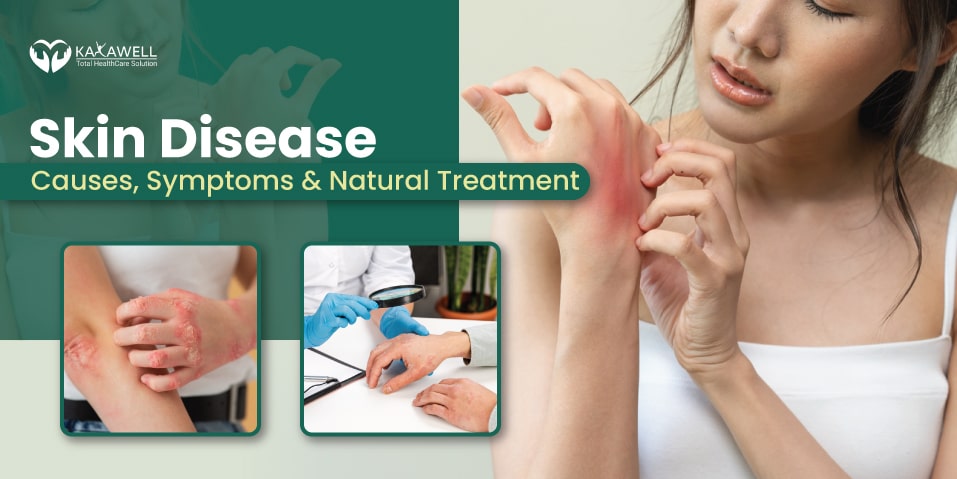 Skin disease Causes Symptoms and Natural Treatment