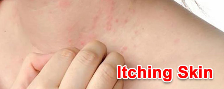 winter season diseases