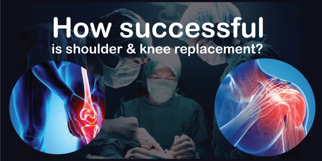 what is the success rate of shoulder replacement surgery