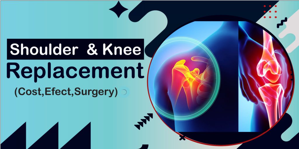 Knee and Shoulder Replacement Cost, Effect & Surgery
