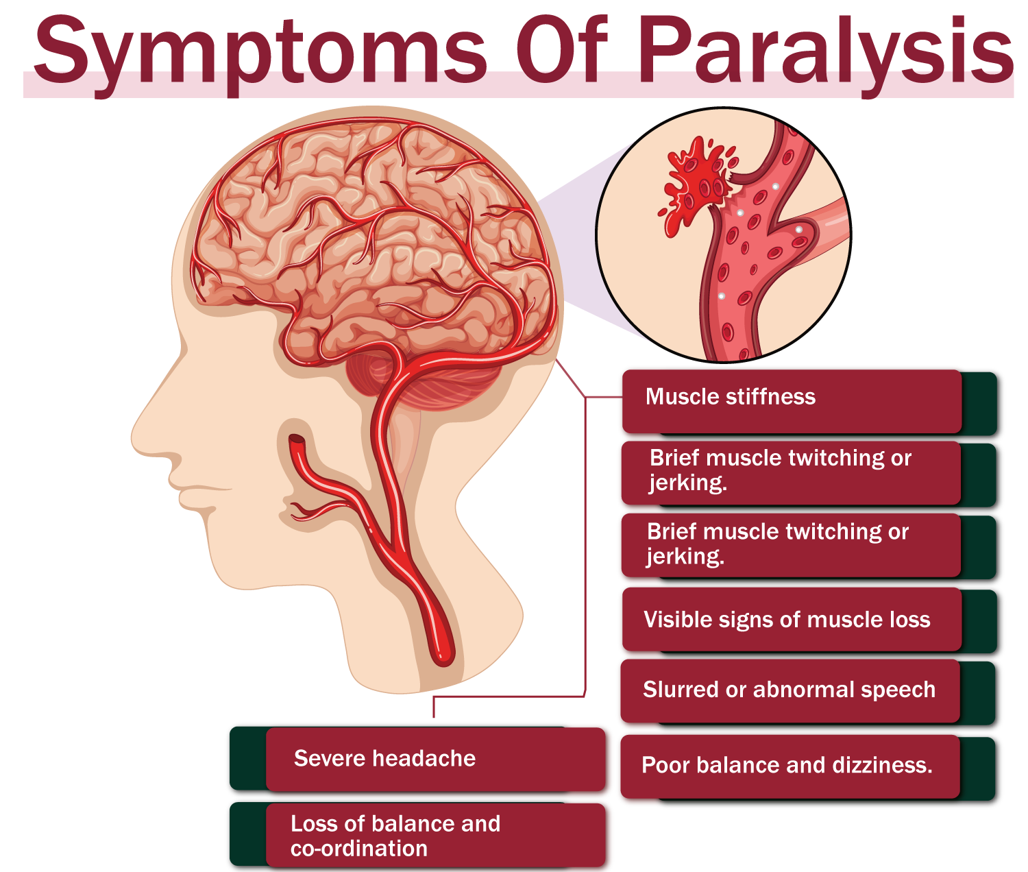 paralysis and speech problems are associated with which condition