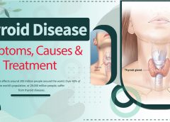 Thyroid disease symptoms