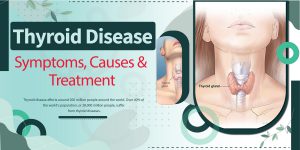 Thyroid disease symptoms