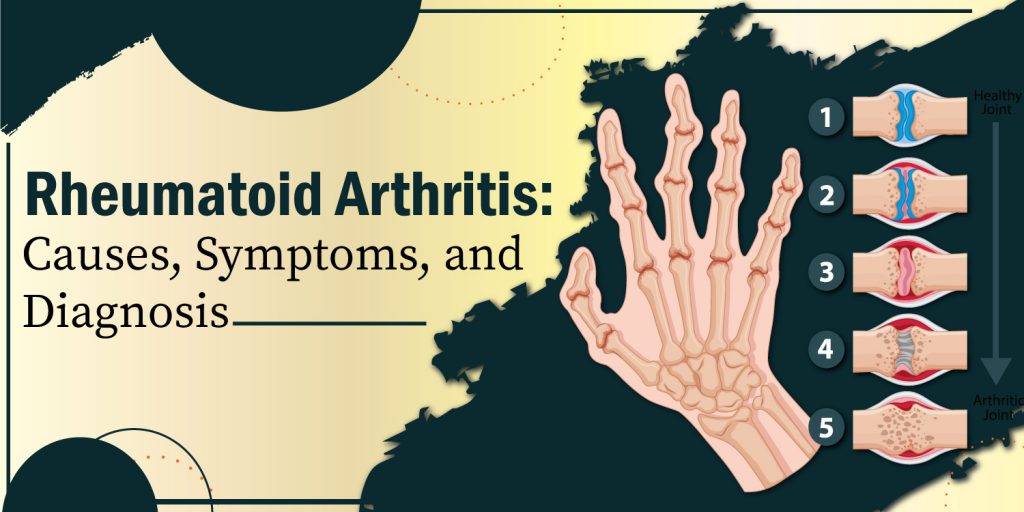 Rheumatoid Arthritis Causes, Symptoms And Diagnosis