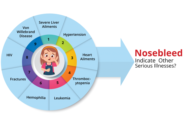 What Causes Nosebleeds with Blood Clots? kayawell