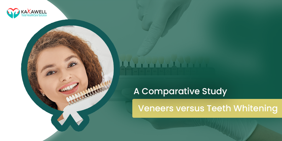A Comparative Study Veneers versus Teeth Whitening