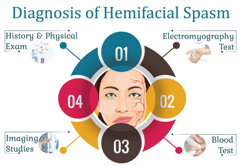 Hemifacial Spasm Symptoms, Causes, and Treatments