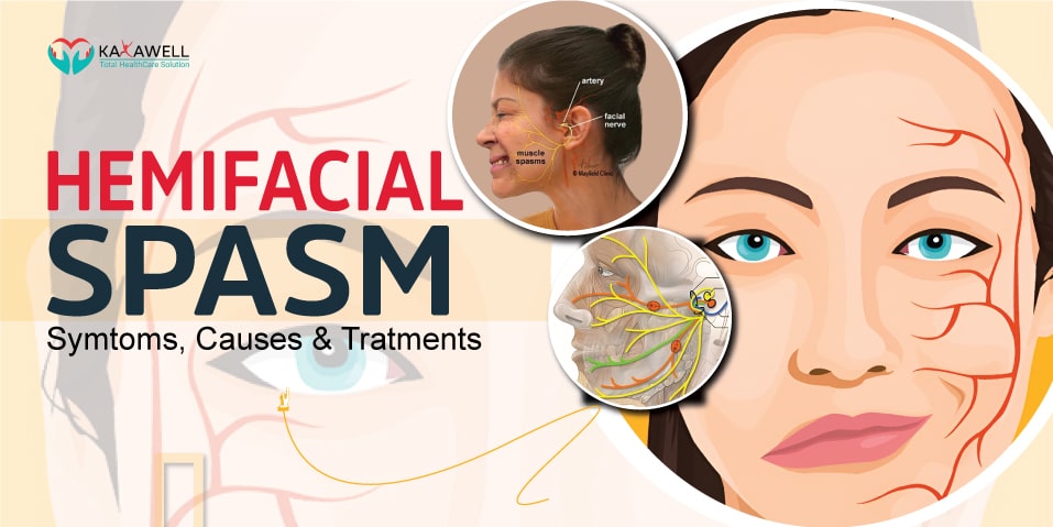 hemifacial spasm causes