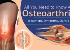 Osteoarthritis Sign & Symptoms