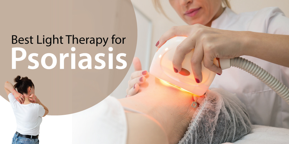 Therapy for Psoriasis
