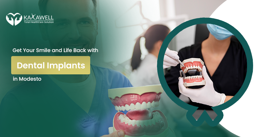 Get Your Smile and Life Back with Dental Implants in Modesto