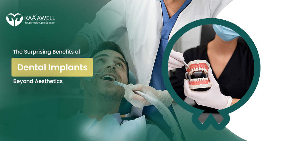 The Surprising Benefits of Dental Implants Beyond Aesthetics