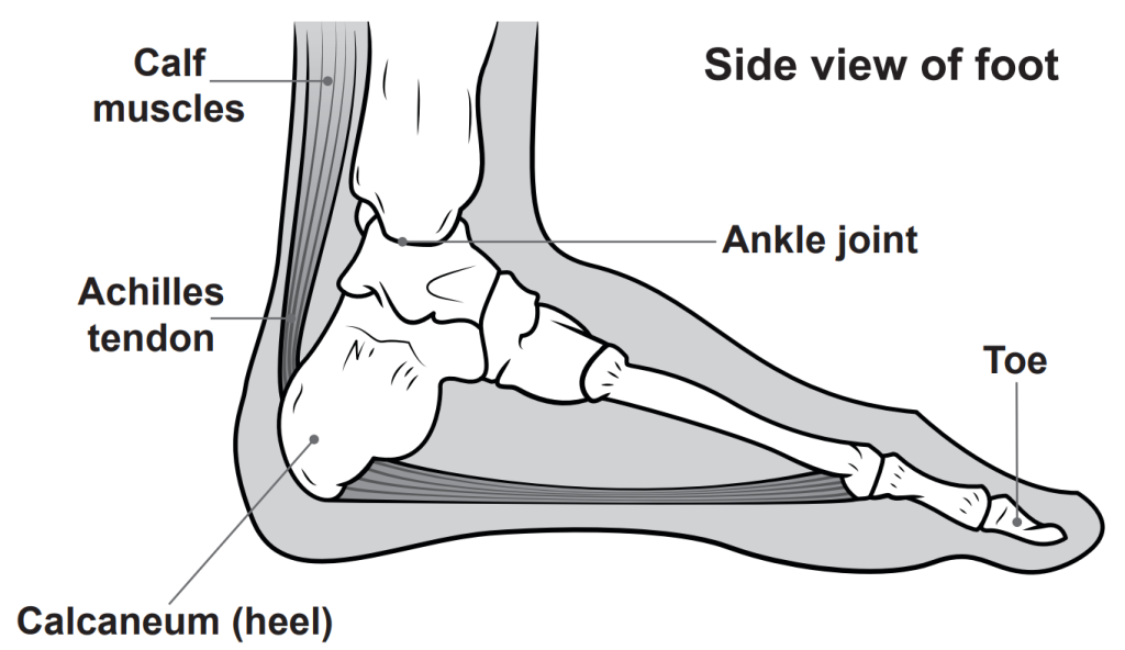cleveland clinic achilles tendon