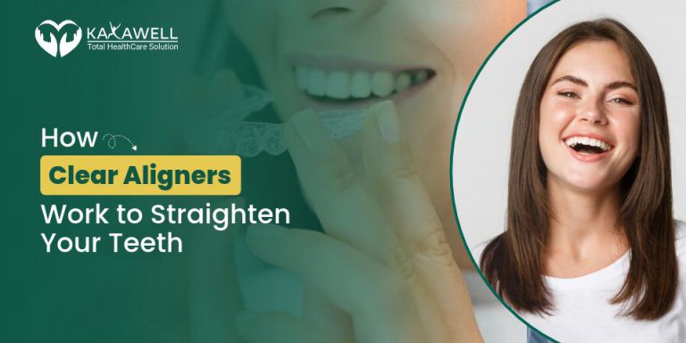 How Clear Aligners Work to Straighten Your Teeth