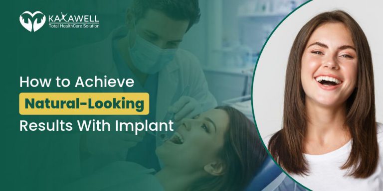 Natural-Looking Results With Implants